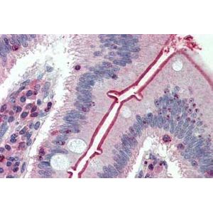 p-Nitrobenzyl mesylate, Alkylation reagent(AB138910)