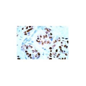 Estrogen Receptor alpha (F-10) AC