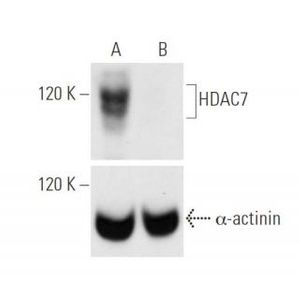 HDAC7 siRNA (h)