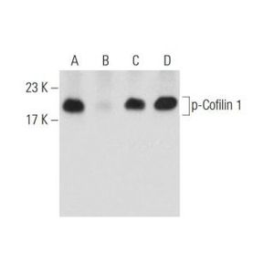 Phosphatase Inhibitor Cocktail B