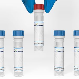 Mouse Anti-gp120 Recombinant Antibody (8F1F7)