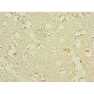 Anti-CPT1A antibody [8F6AE9](AB128568)