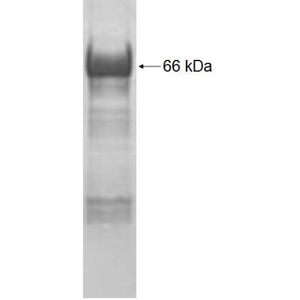 Recombinant Human ADH4 protein, GST-tagged