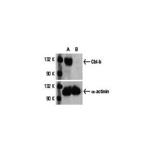 Cbl-b siRNA (h)