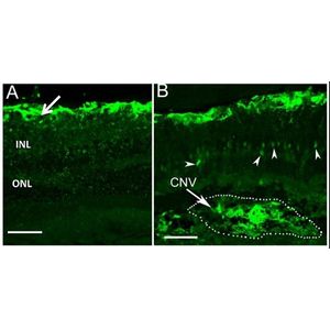 Anti-S100 beta antibody [EP1576Y] - Astrocyte Marker