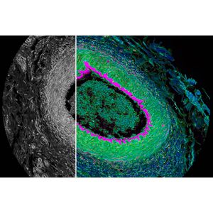 STELLARIS 8 FALCON FLIM Microscopes