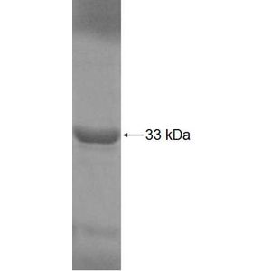 Recombinant Human ADHFE1 protein, His-tagged
