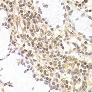 Anti-PHC1 antibody