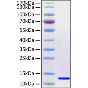 2019-nCoV Envelope Protein
