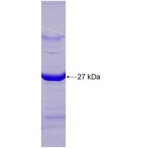 Recombinant Human ABHD14B protein, His-tagged