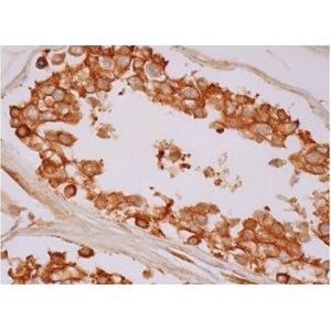 Centriolin (C-9) FITC