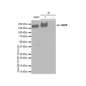 Anti-EGFR antibody [EP38Y]