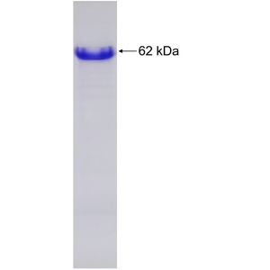 Recombinant Human AKAP1 protein, His-tagged