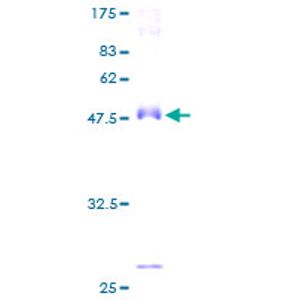 Recombinant Human AMACR protein, GST-tagged