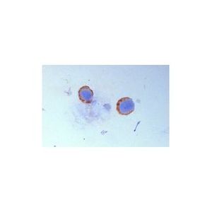 Integrin β2 (M18/2) L