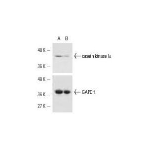 casein kinase Iε siRNA (h)