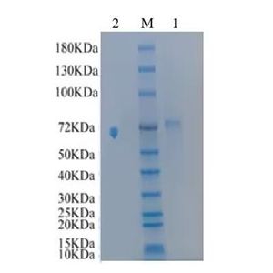 Recombinant Pig ANGPT2 Protein, N-His tagged
