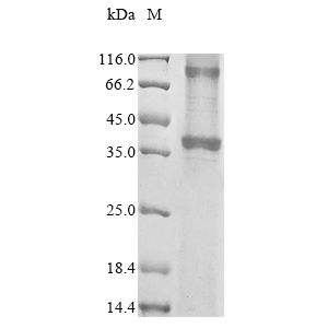 Anti-Telomerase reverse transcriptase antibody [Y182](AB32020)