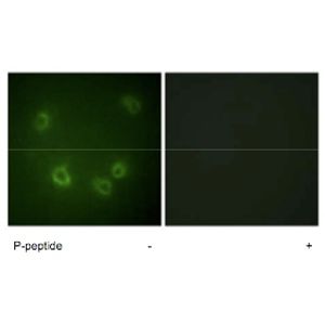 Choline/Acetylcholine Assay Kit(AB65345)