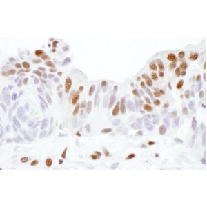 Human Anti-Epstein Barr virus IgG ELISA Kit (EBV-VCA)(AB108730)