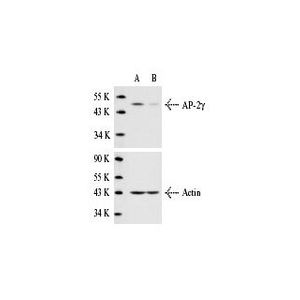 AP-2γ siRNA (h)