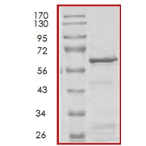 Anti-Tyrosine Hydroxylase antibody [EP1532Y] - Neuronal Marker(AB137869)