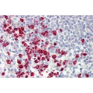 Anti-Cyclin D1 antibody [EPR2241] - C-terminal(AB134175)