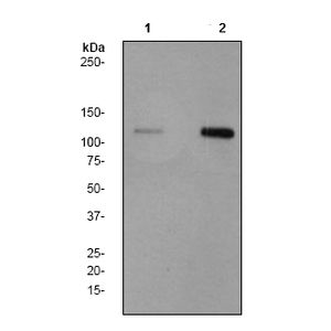 Mouse PCSK9 ELISA Kit(AB215538)