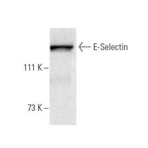 E-Selectin (CTB202) PE