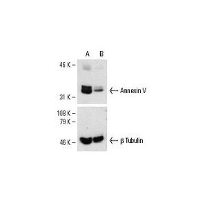 Annexin V siRNA (h)