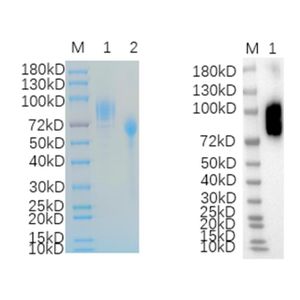 Recombinant Rhesus Monkey ADGRE2 Protein, 19-530aa, C-His tagged