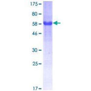 Anti-YAP1 antibody [EP1674Y](AB52771)