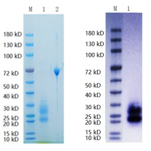 Recombinant Rat AMHR2 Protein, His tagged