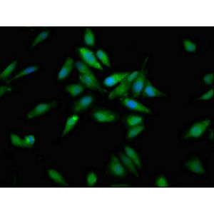 Anti-CD20 antibody [L26](AB9475)