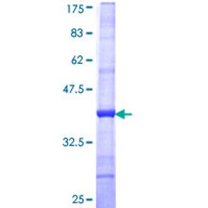 Human PEDF ELISA Kit(AB246535)