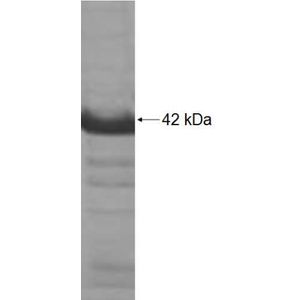 Recombinant Human ADD2 protein, His-tagged
