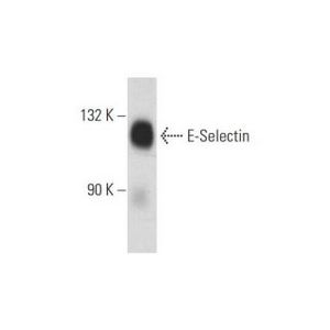 E-Selectin (P2H3)