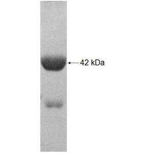 Recombinant Human ACAD9 protein, His-tagged