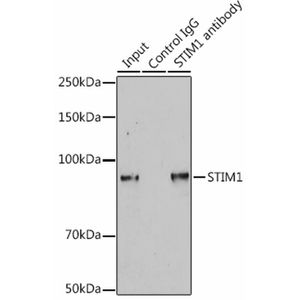 Anti-STIM1 antibody