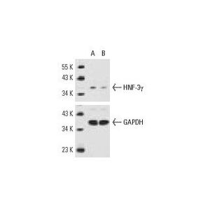 HNF-3γ siRNA (h)