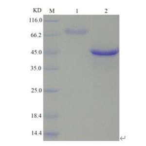 Recombinant Human AADC Protein, His-tagged