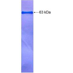 Recombinant Human AKR1C3 protein, GST-tagged