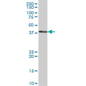 Human GDF-15 ELISA Kit(AB155432)