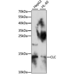 Anti-CLC antibody