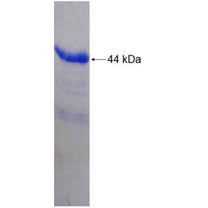 Recombinant Human ABL2 protein, His-tagged
