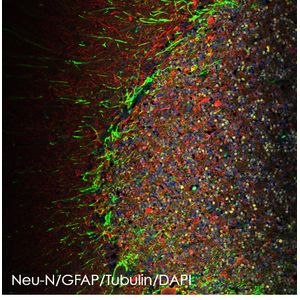 Anti-GFAP antibody [EPR1034Y]