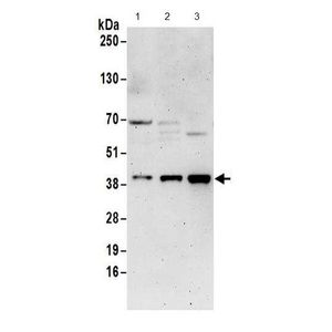 Anti-Lrp2 / Megalin antibody(AB76969)