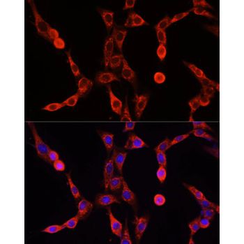 Anti-ABCD1 antibody | Science Company | Labroots