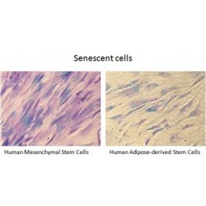 Senescence Kit -for Transfection Assay