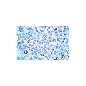 Stat3 (F-2) Alexa Fluor® 594